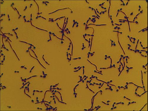Candidiasis – Candida albicans Microscopic Pathology Image