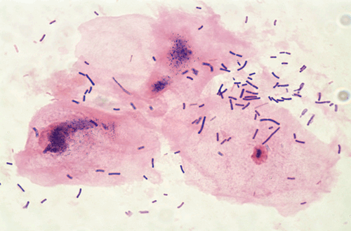 Normal Vaginal Epithelial Cells Microscopic Pathology Image