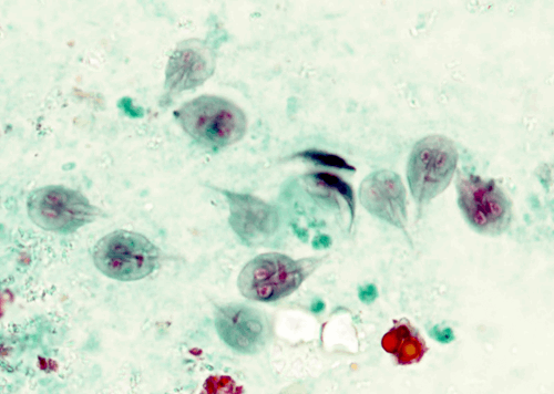 Giardiasis – Giardia trophozoites Microscopic Pathology Image